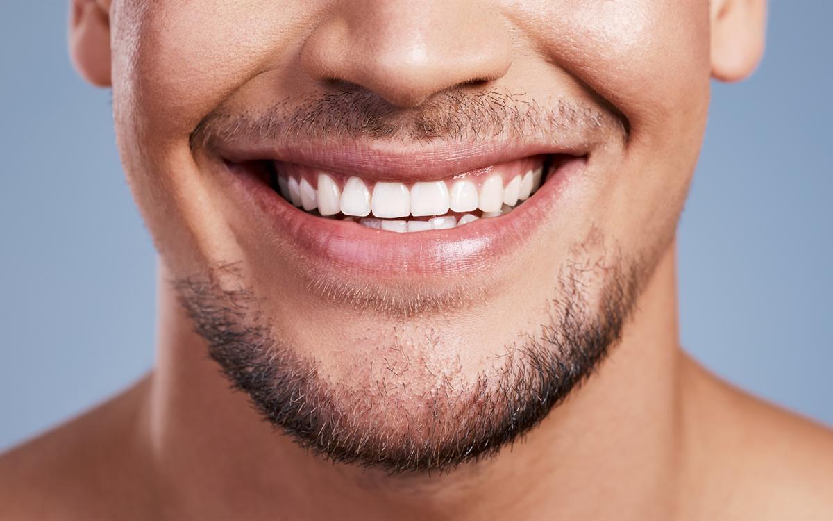 Primer plano de la sonrisa de un hombre con los dientes alineados.